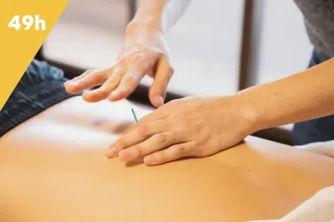 dry needling intégral