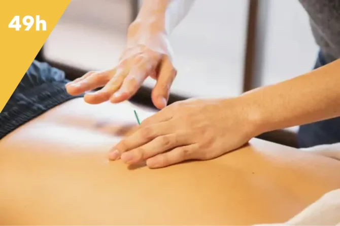 dry needling intégral