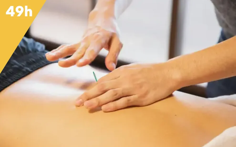 dry needling intégral