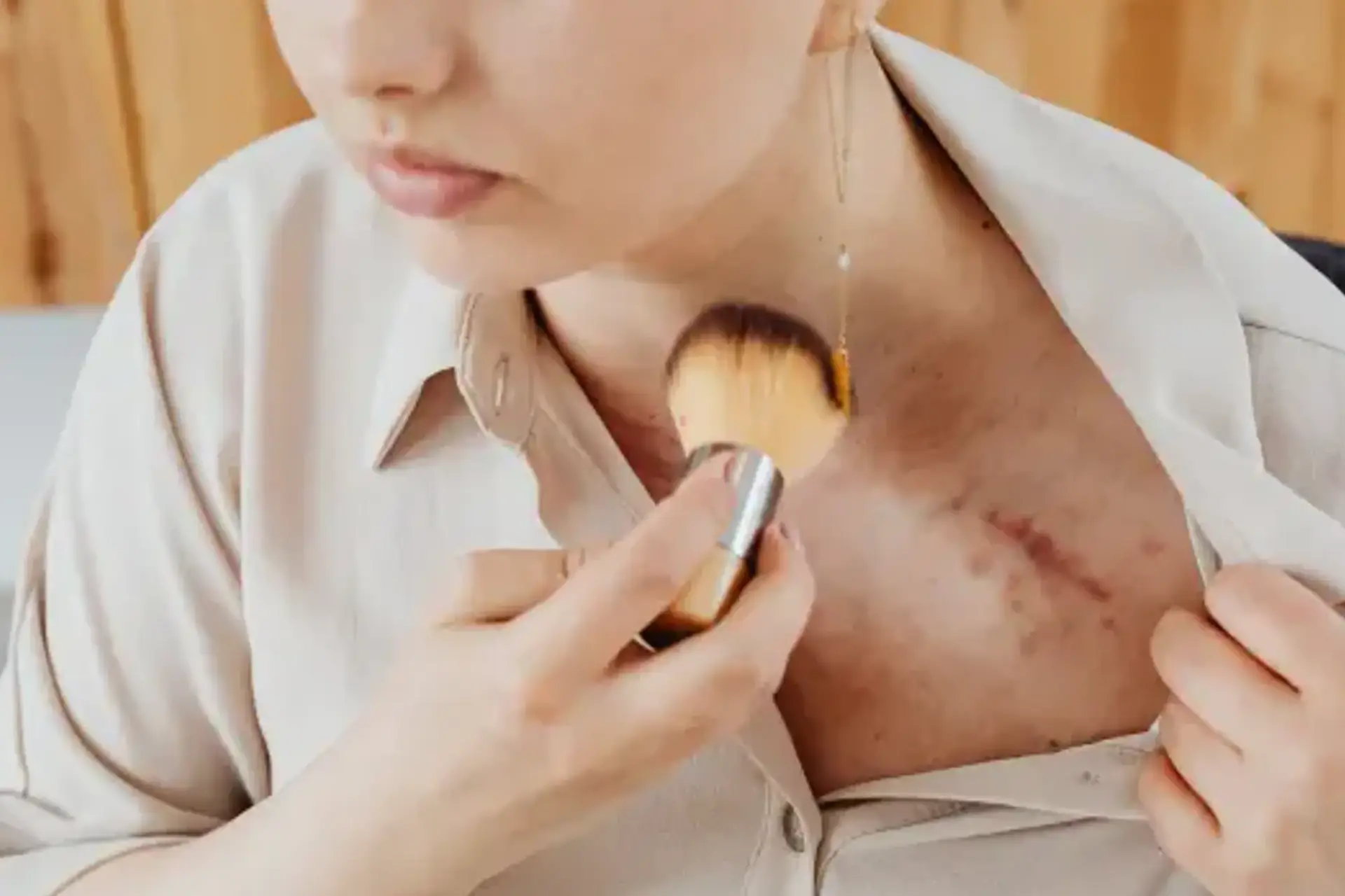 Plaies et processus de cicatrisation essentiel